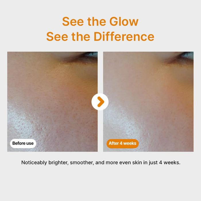 [SUMSAE] Pure Vitamin C Serum 30ml
