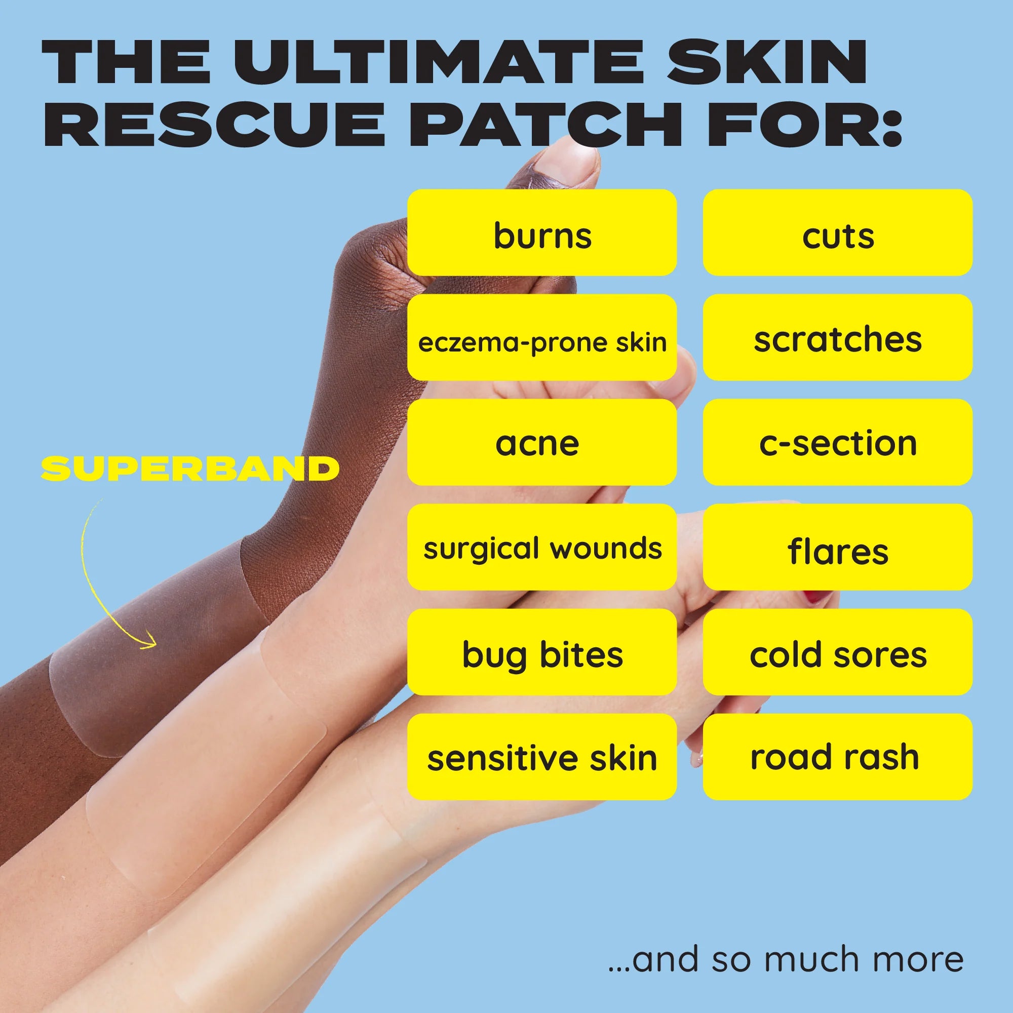 [MAKE-IT-SKIN] Superband Cut-To-Size (3 Bandages)