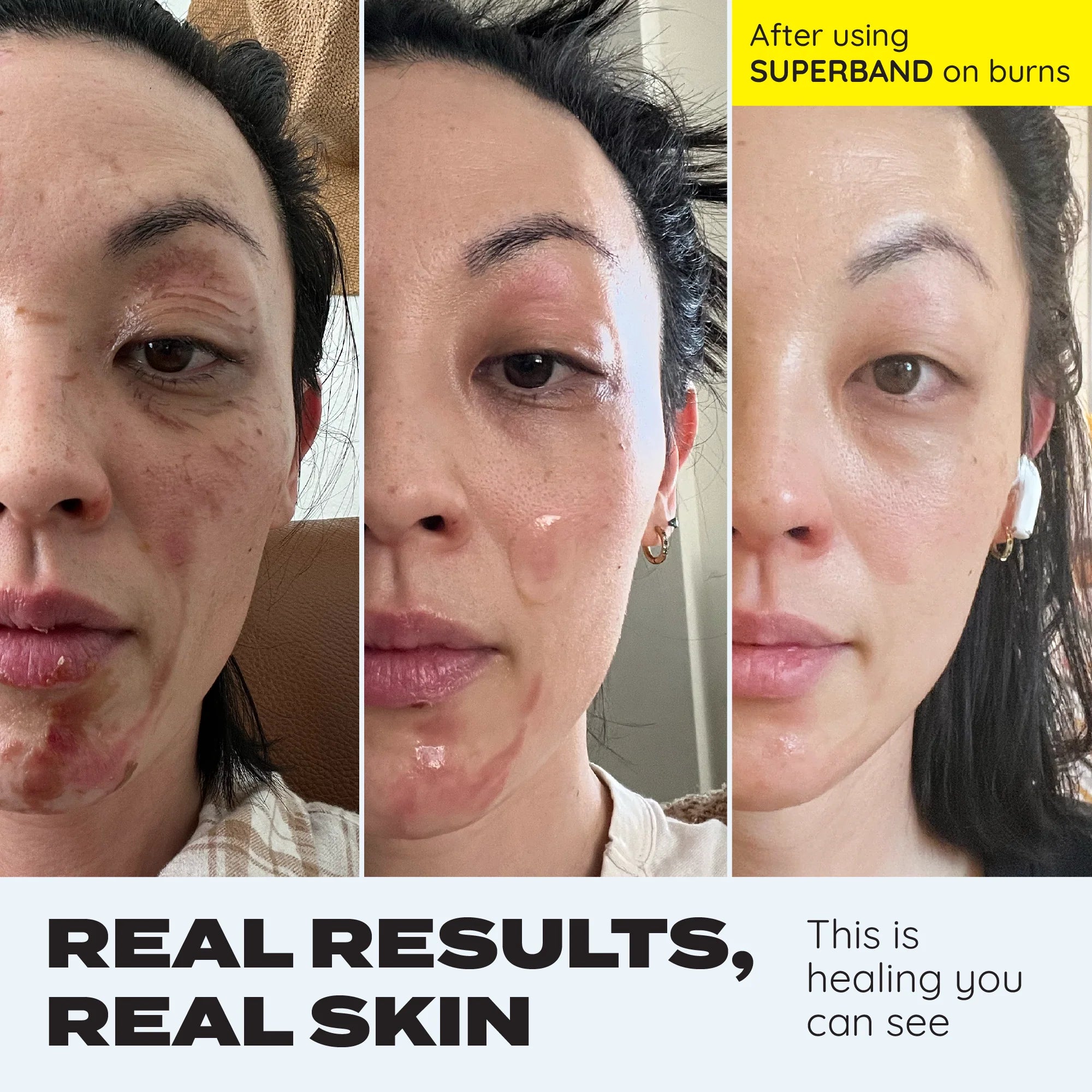 [MAKE-IT-SKIN] Superband Cut-To-Size (3 Bandages)