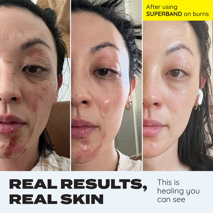 [MAKE-IT-SKIN] Superband Cut-To-Size (3 Bandages)